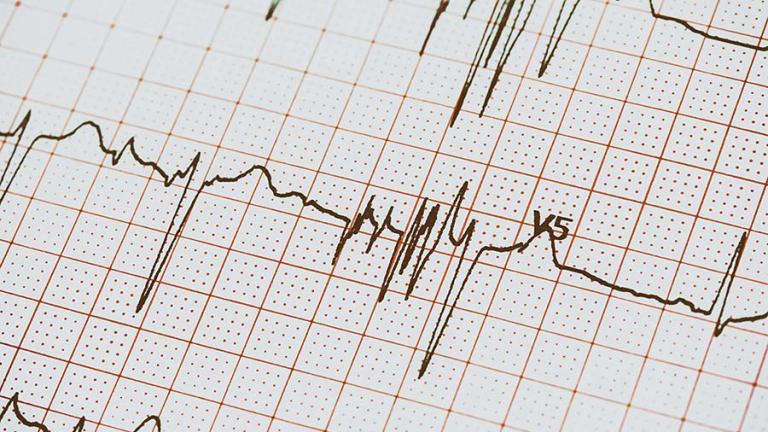 Detección personal de arritmias cardiacas