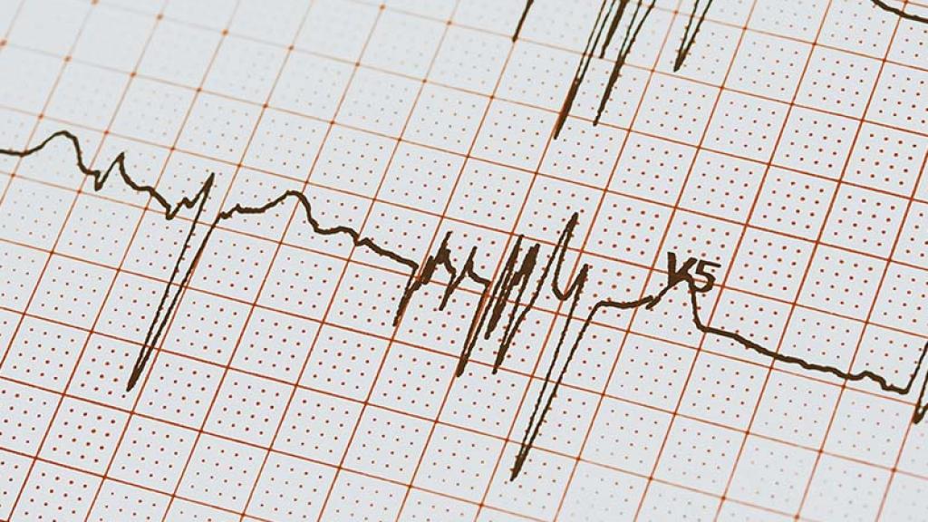Detección personal de arritmias cardiacas