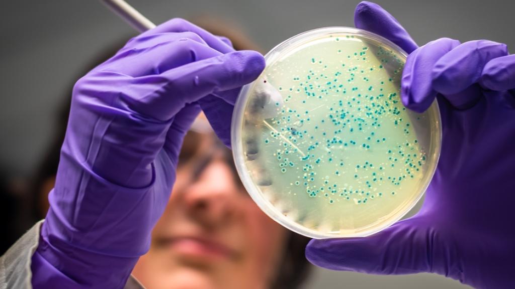 Efecto de Microbioma en Resistencia a Cáncer Colorrectal